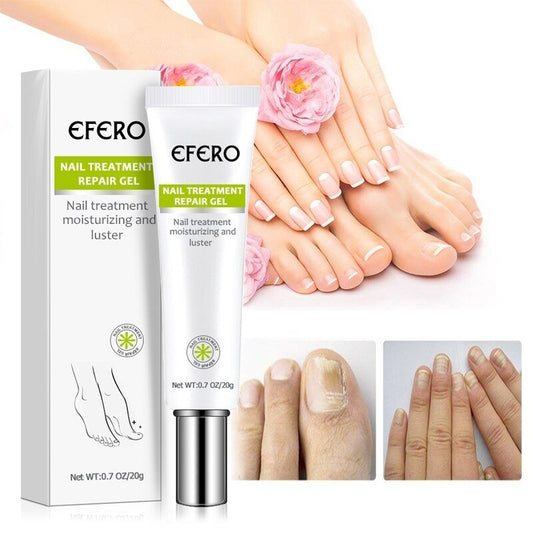 NailReborn – Nagelversterking voor gezonde en mooie nagels [1 + 1 Gratis]