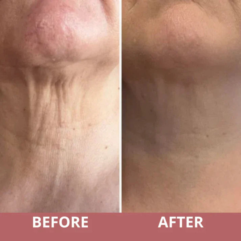 NeckLuxe™ – Anti-Aging Halsverzorging met 360° Massage-Roller