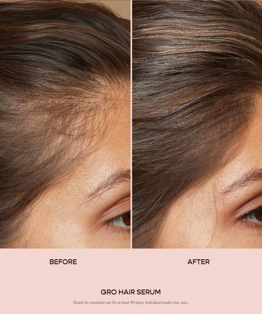 GlowRoots™ – Intensief verzorgend haarserum voor zichtbaar dikker en gezonder haar [50% Korting]