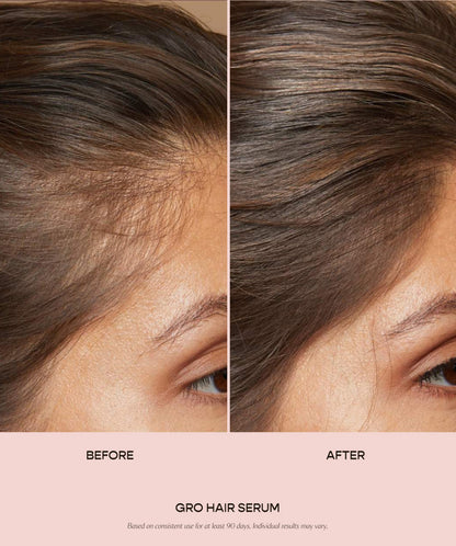 GlowRoots™ – Intensief verzorgend haarserum voor zichtbaar dikker en gezonder haar [50% Korting]