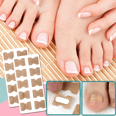 FinePatches™ – Correctiepleisters voor mooie, sterke en gezonde nagels [50% Korting]