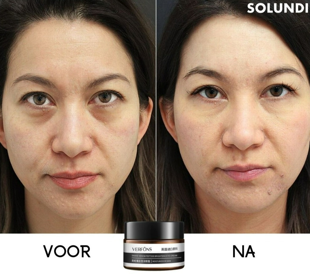 EyeRejuv™ – Verbazingwekkende oogcrème voor stralende, gladde & jeugdige huid [1 + 1 Gratis]