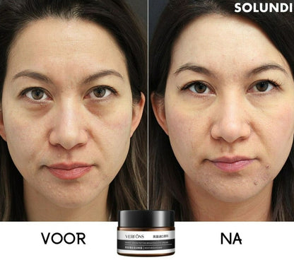 EyeRejuv™ – Verbazingwekkende oogcrème voor stralende, gladde & jeugdige huid [1 + 1 Gratis]