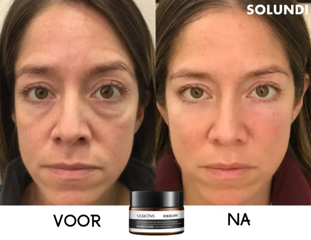 EyeRejuv™ – Verbazingwekkende oogcrème voor stralende, gladde & jeugdige huid [1 + 1 Gratis]