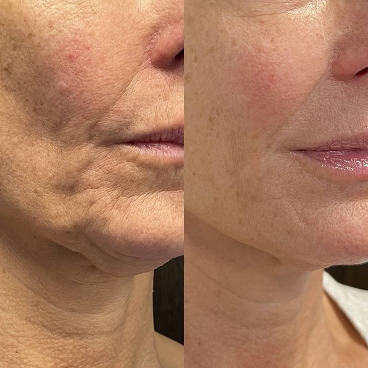 Nectare – Anti-Aging Serum Stick voor zichtbaar jongere huid [50% korting]