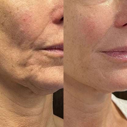 Nectare – Anti-Aging Serum Stick voor zichtbaar jongere huid [50% korting]