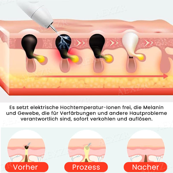 50% Korting | LuminSkin™ - Zeg vaarwel tegen vlekken [Laatste dag korting]