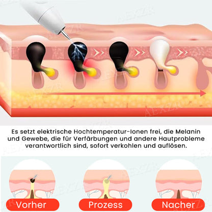 50% Korting | LuminSkin™ - Zeg vaarwel tegen vlekken [Laatste dag korting]