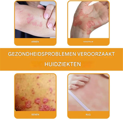 HoneyGlow™ Bijengif Crème – Kalmerende Huidverzorging [1+1 Gratis]