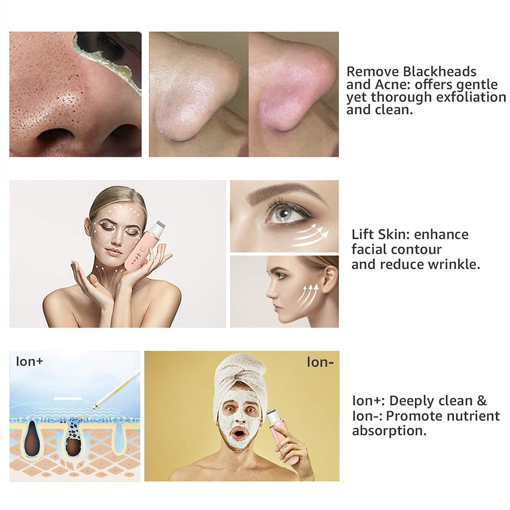 DermaVibe™ – Dieptereiniging van poriën voor een gezonde, stralende huid [50% Korting]