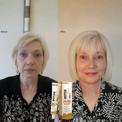 Apiluxe™ Bijengif Jeugdcrème – Anti-Aging Crème voor Strakke & Gladde Huid [1+1 Gratis]