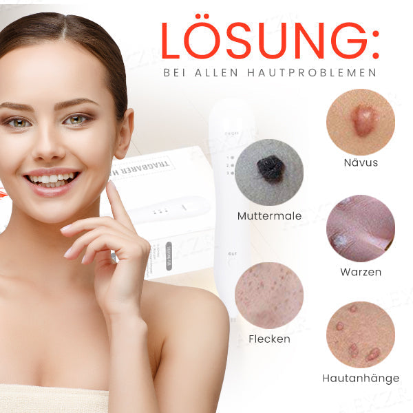 50% Korting | LuminSkin™ - Zeg vaarwel tegen vlekken [Laatste dag korting]