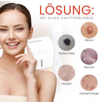50% Korting | LuminSkin™ - Zeg vaarwel tegen vlekken [Laatste dag korting]