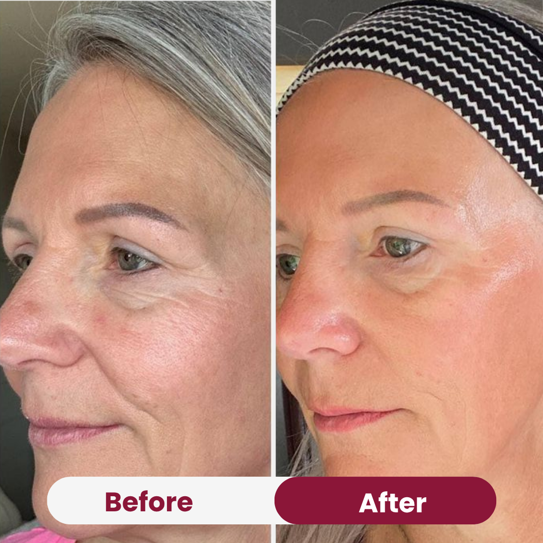 Nifora™ – Intensief Verzorgend Masker voor Jeugdige, Stralende Huid [1 + 1 Gratis]