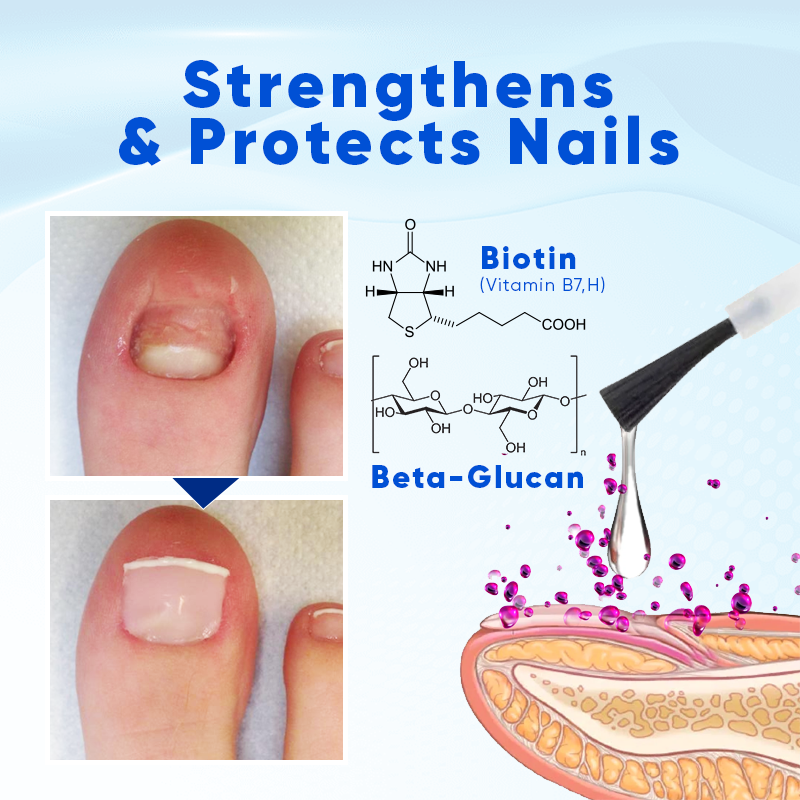 Biancat™ OnyxoGuard Nagelserum – Sterke & Gezonde Nagels [1+1 Gratis]