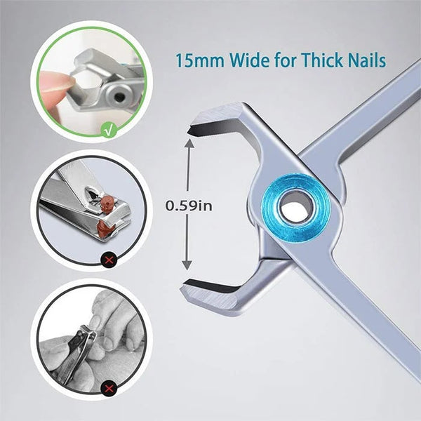 NailMate™ – Zacht, precies nageltrimmen voor perfecte verzorging [50% Korting]