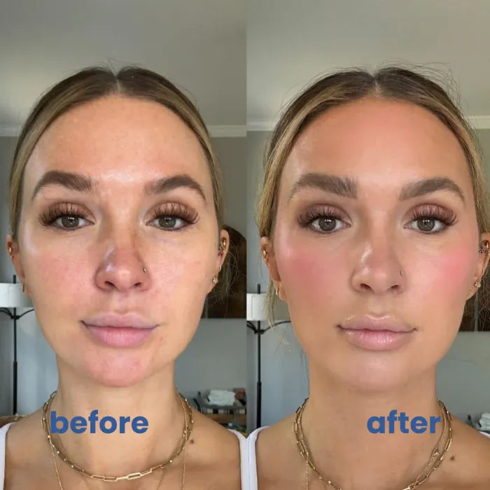 BrightSkin™ – Kalmerende verzorging voor een perfecte, stralende huid [1 + 1 Gratis]