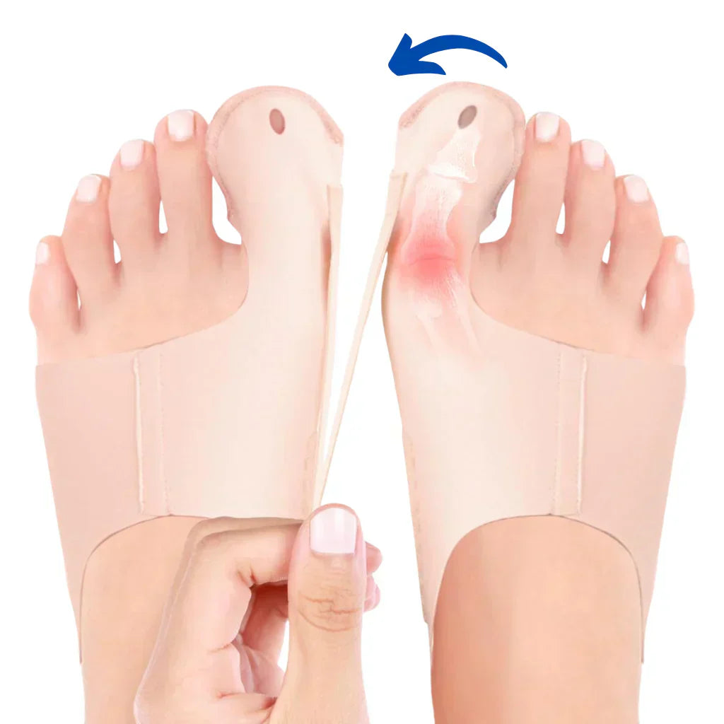 HalluxValgus™ - Jouw comfortabele oplossing voor pijnvrije voeten! [1 + 1 Gratis]
