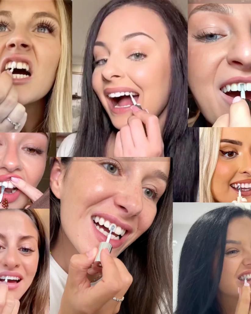 LuminaWhite™ – Directe vlekneutralisator voor gele, hardnekkige verkleuringen [50% Korting]