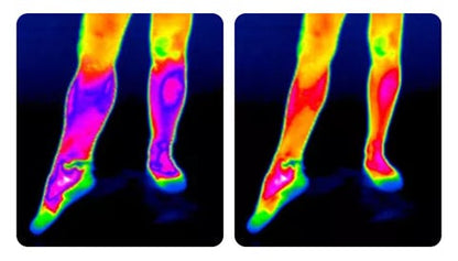 KneeBand™ – Snelle, effectieve verlichting bij kniepijn en spanning [50% Korting]