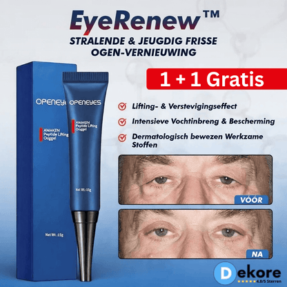 EyeRenew™ – Zichtbaar frisse oogcontour met liftend effect [1 + 1 Gratis]