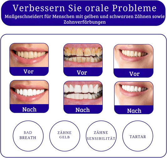 HeroSmile™ – Kleuren­correctieserum & paarse tandpasta voor stralend witte tanden [1 + 1 Gratis]