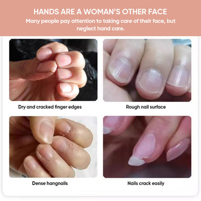 NailGrowth™ – Hydraterende & versterkende formule met vitamine E & biotine, 5 g [50% Korting]