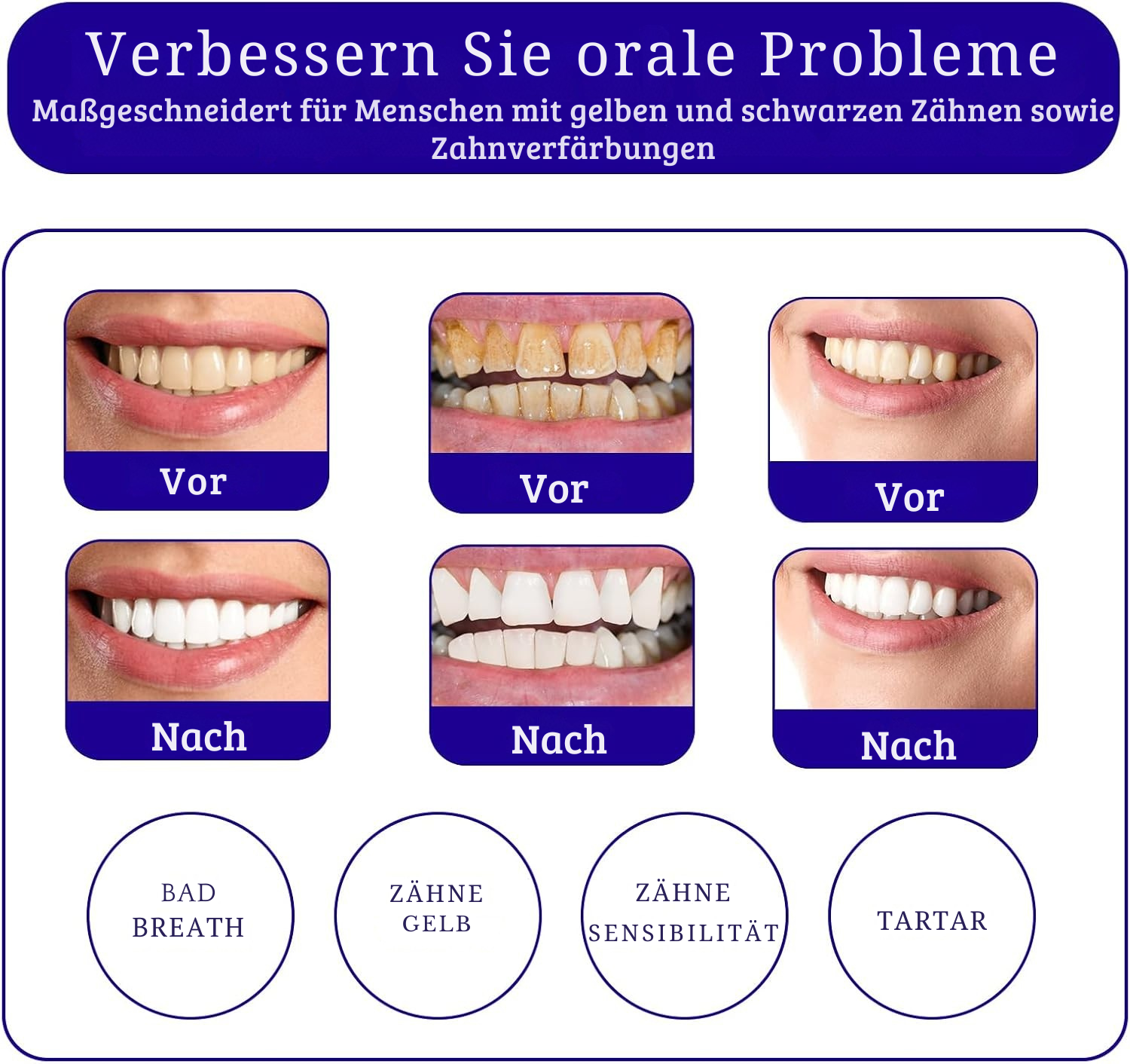 WhiteSmile™ – Kleuren­correctie-Serum & Paarse Tandpasta voor Stralend Witte Tanden [1 + 1 Gratis]