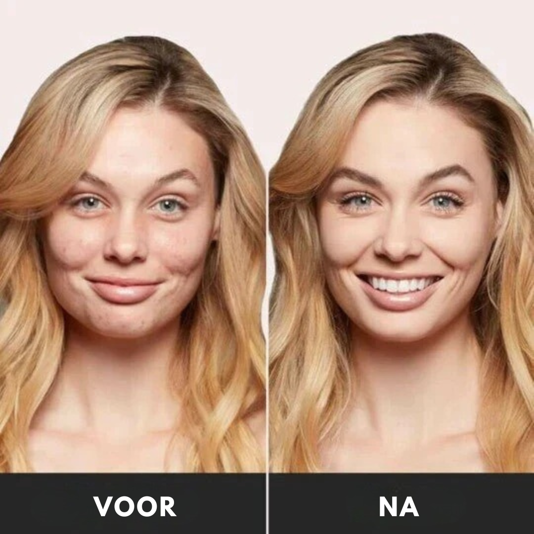CHAFFUL™ CC-Crème – Egale & Stralende Teint met Vitamine E [1+1 Gratis]