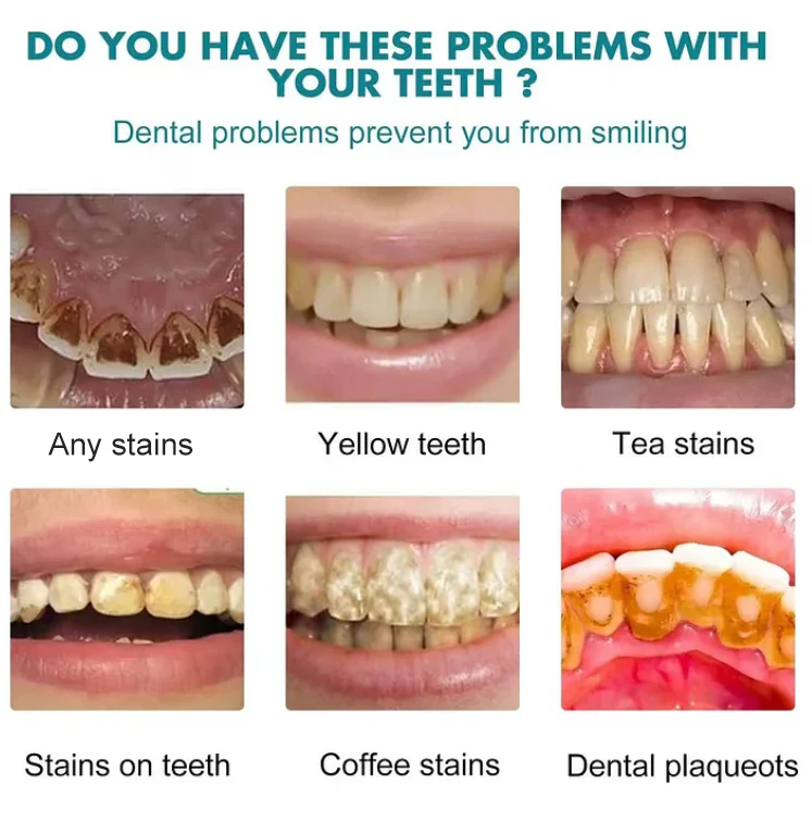 LuminaWhite™ – Directe vlekneutralisator voor gele, hardnekkige verkleuringen [50% Korting]