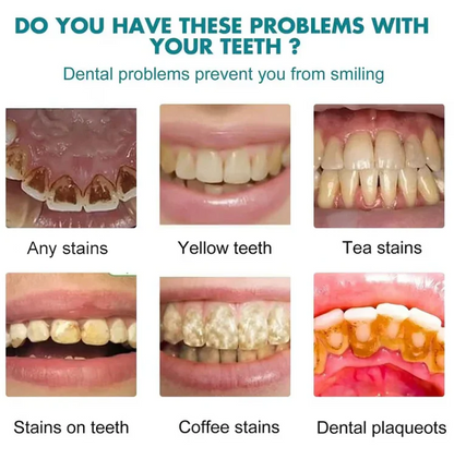 LuminaWhite™ – Directe vlekneutralisator voor gele, hardnekkige verkleuringen [50% Korting]