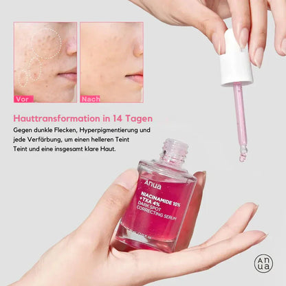 AnuaNiacinamide™ – Stralende en gezonde huid in elke druppel [1 + 1 Gratis]