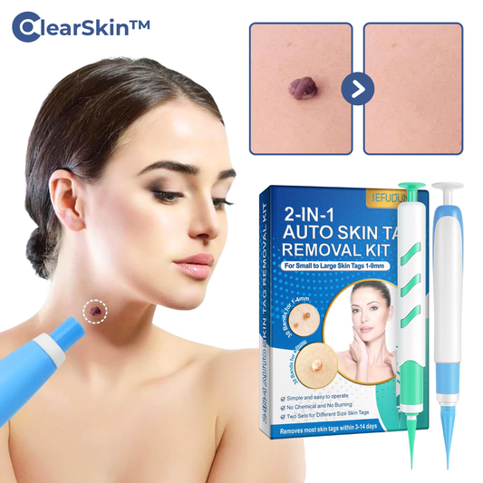 ClearSkin™ – Wrattenverwijderaar-pen voor snelle, effectieve & zachte huidbehandeling [50% Korting]