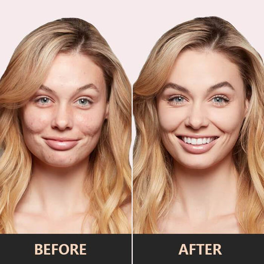 FlawlessSkin™ – 3-in-1 Correctiepalet voor een vlekkeloze, stralende en egale huid [50% Korting]