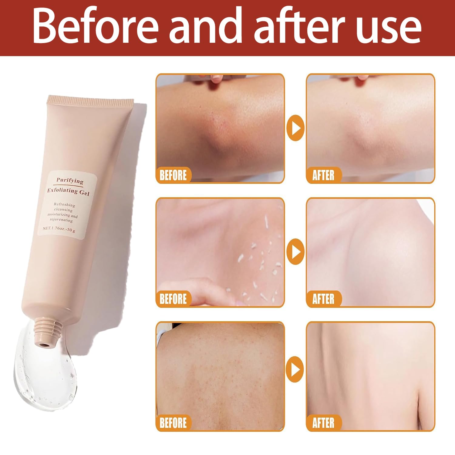 FreshSkin™ – Onthult een zijdezachte, stralende en soepele huid [1 + 1 Gratis]
