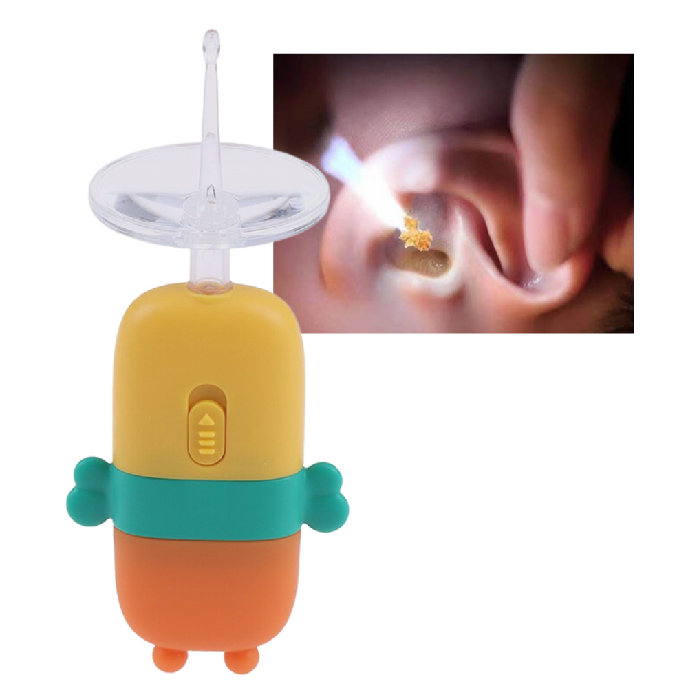 ClearScope™ – Zachte oorsmeerverwijdering [50% Korting]