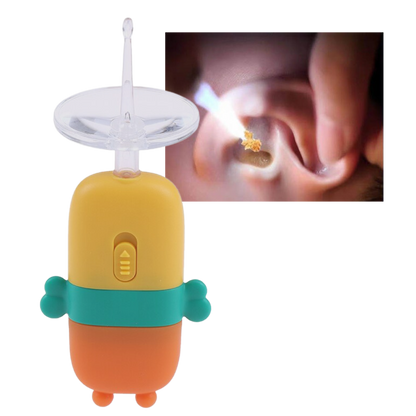 ClearScope™ – Zachte oorsmeerverwijdering [50% Korting]