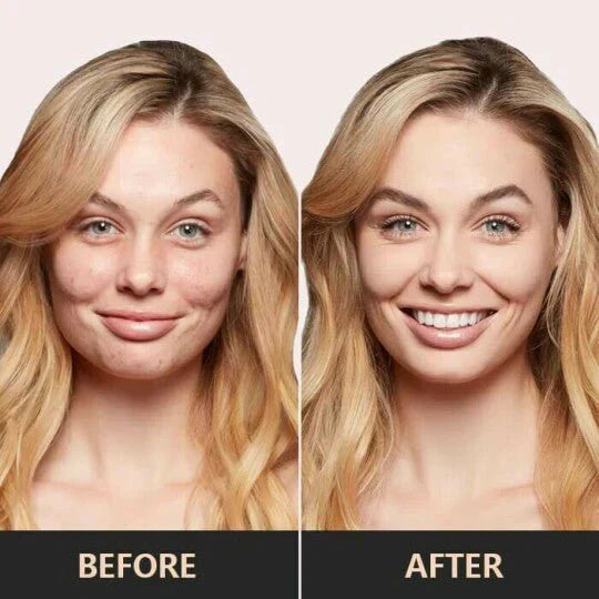 SkinNourish™ – Altijd een huid die klaar is voor de foto [1 + 1 Gratis]