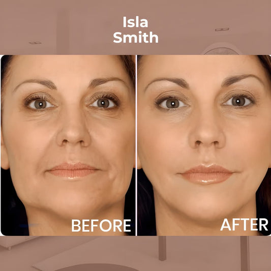 LiftEase™ - Onzichtbare, verstevigende behandeling! [1 + 1 Gratis]