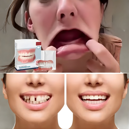 Dentivo™ – Snapprothesen Set voor een eenvoudige, veilige en comfortabele tandprothesen oplossing [50% Korting]