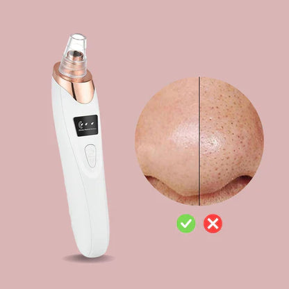 SkinClear™ Poriënreiniger – Verwijder Mee-eters & Krijg een Zuivere Huid