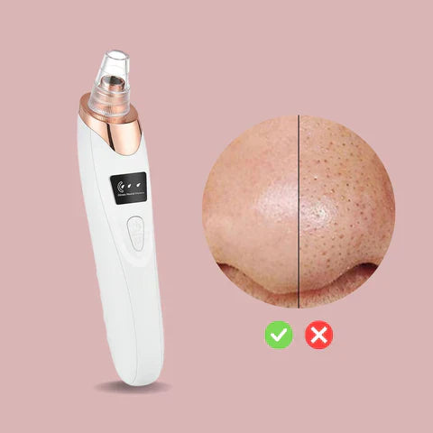 SkinClear™ – Eindelijk zuivere, vlekkeloze huid zonder puistjes, fris en stralend [50% korting]