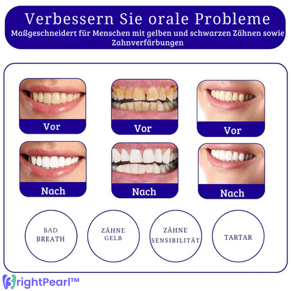 BrightPearl – Stralend witte tanden met kleurcorrectie-serum & paarse tandpasta [1 + 1 Gratis]