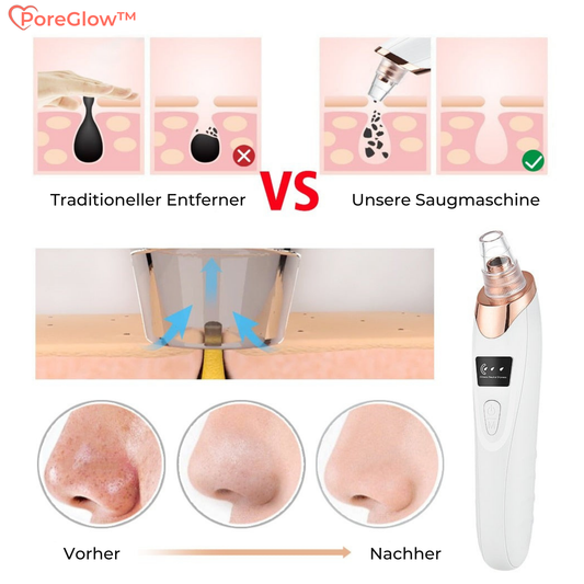 PoreGlow™ – Blackhead Verwijder Set voor grondige en effectieve huidreiniging [50% Korting]