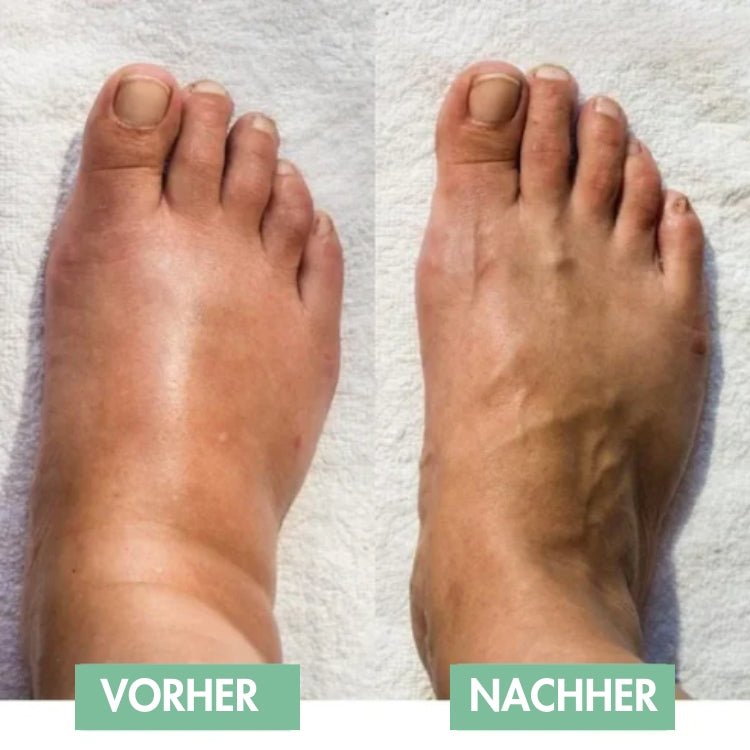 Revivax™ - De innovatieve EMS voetmassage voor onmiddellijke verlichting! [50% Korting]