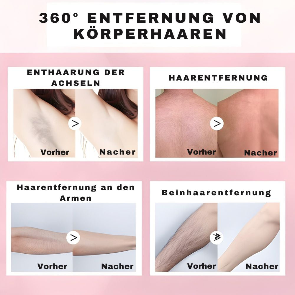 Smoothara – Zachte haarverwijdering zonder scheren [1 + 1 Gratis]