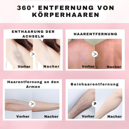Smoothara – Zachte haarverwijdering zonder scheren [1 + 1 Gratis]