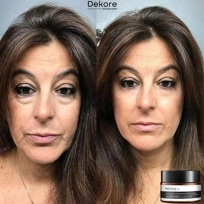 EverYouth™ – Ontdek vandaag nog de bron van je verjonging [50% Korting]