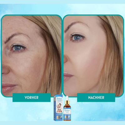 YouthGlow™ – Botox-vrij anti-aging serum voor stralende, jeugdige huid [1 + 1 Gratis]