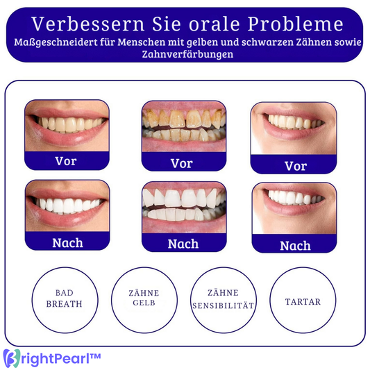 BrightPearl™ – Kleurcorrectie-serum en Paarse Tandpasta voor stralende en verzorgde tanden [1 + 1 Gratis]